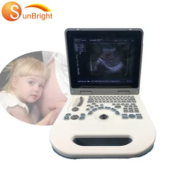 Tıbbi ultrason aletleri temel ultrason ekipmanları taşınabilir dijital ultrason makinesi